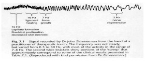 Signal recorded from the hand of a Reiki practitioner at Hartford Hospital